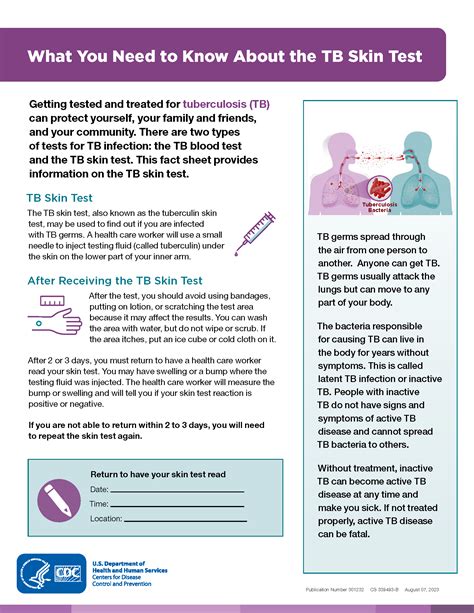 tb skin test information sheet